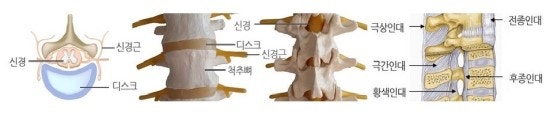 부산의 교통사고 후유증 치유 이제는 극복하자! 정재영한의원