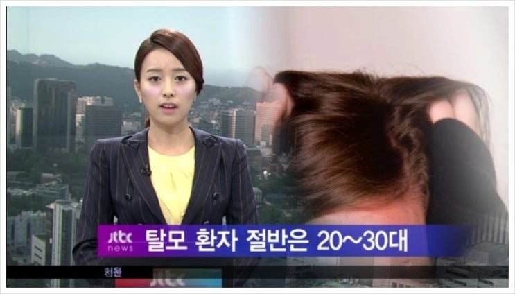  세븐레마의원 'jtbc 20~30대 여성탈모'