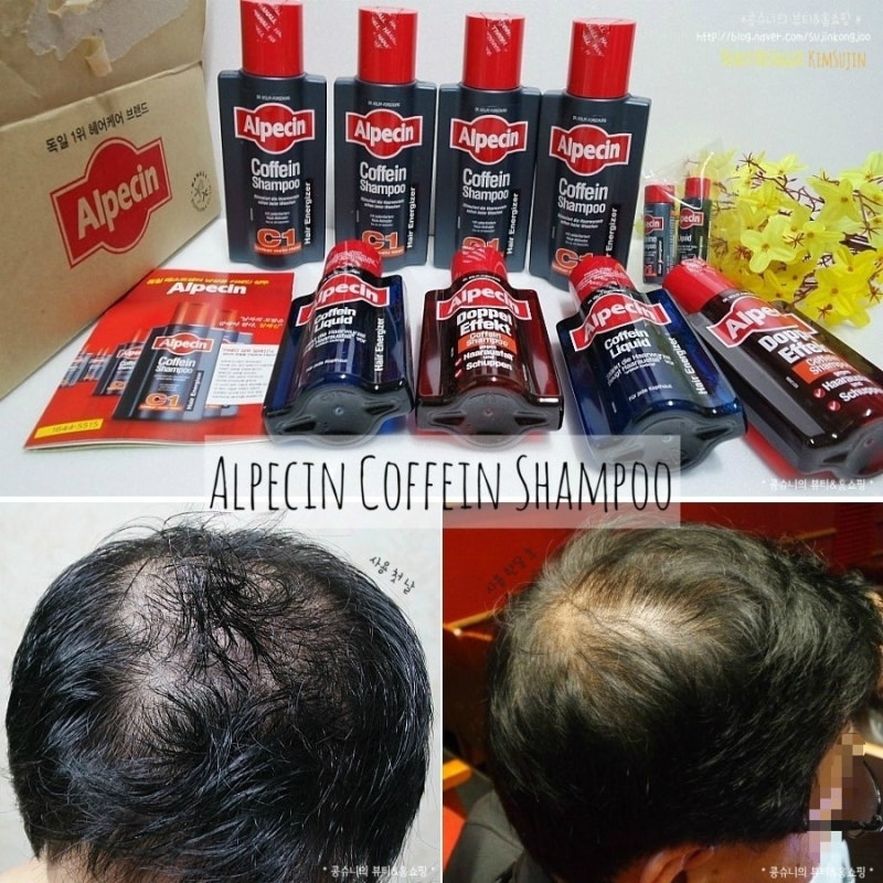 홈쇼핑탈모샴푸 Alpecin, 알페신 카페인샴푸 C1 한달 후기 ♬