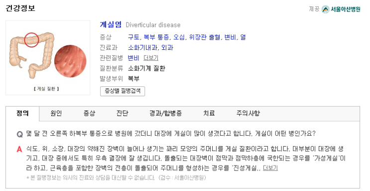  게실염 원인과 증상 