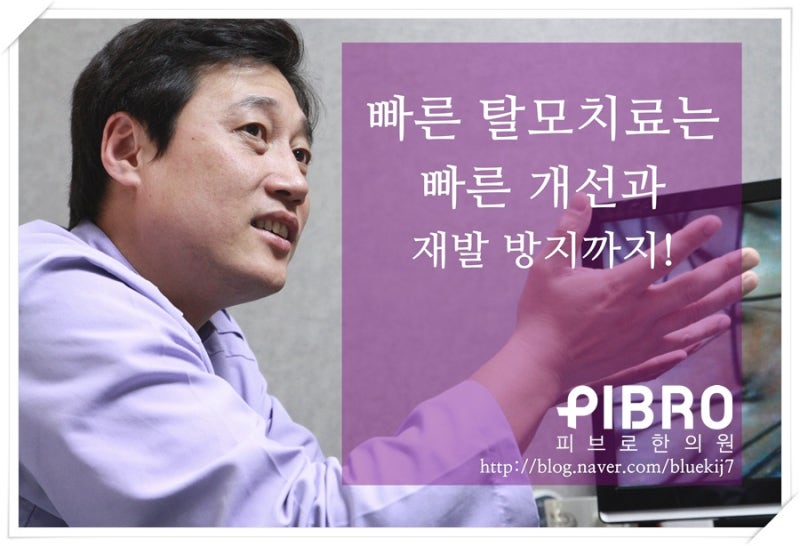 울산탈모 한의원 원형탈모까지?