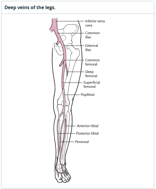 Deep Vein Thrombosis 심부정맥혈전증 네이버 블로그