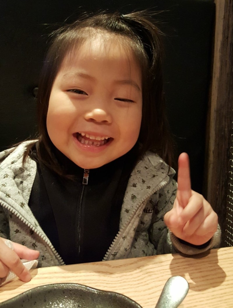 아기 안검하수 수술 전,후 비교