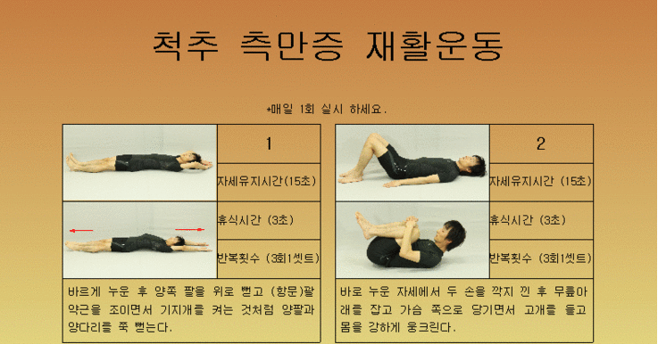  척추측만증의 원인과 재활운동