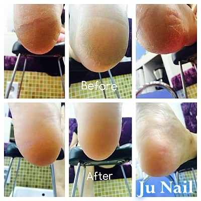 분당용인죽전보정네일/주네일/발각질관리 분당용인죽전보정네일/주네일/발각질관리