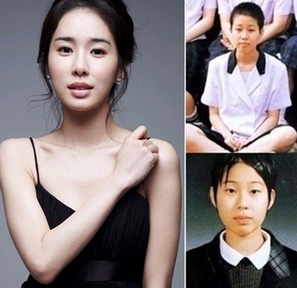 여자연예인 성형 전 후
