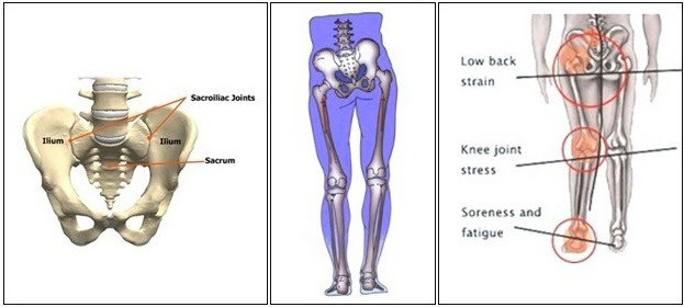 골반이 아파요.골반뼈, 다리쪽 통증까지 획기적인 개선법 5