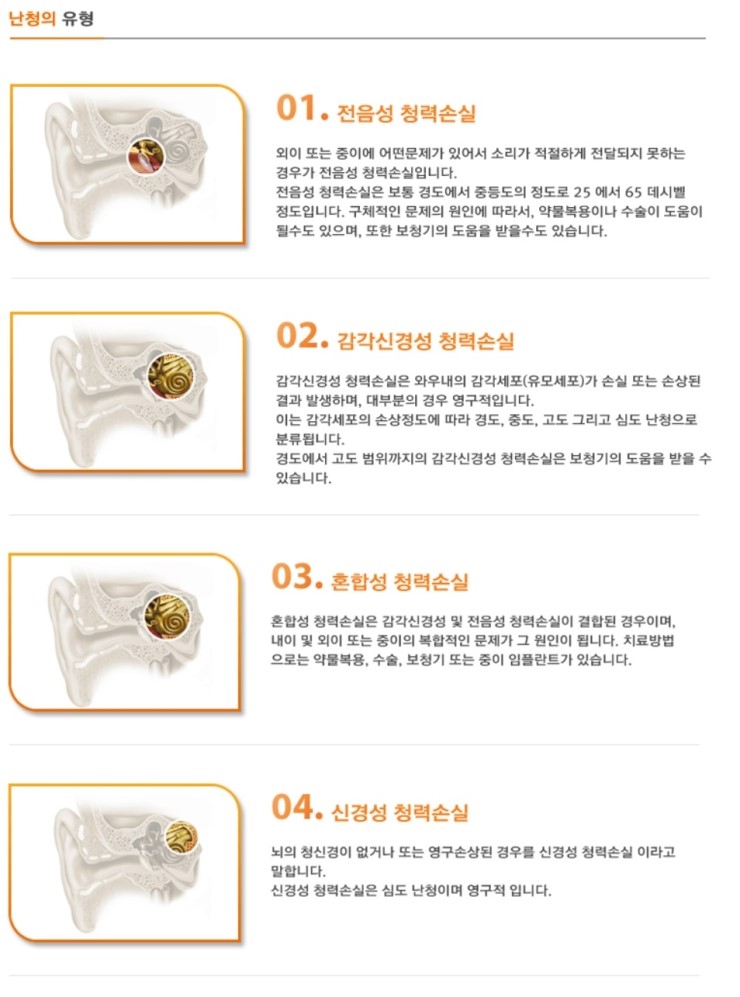  난청의 유형