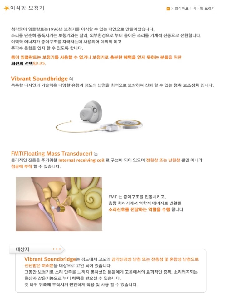  이식형보청기
