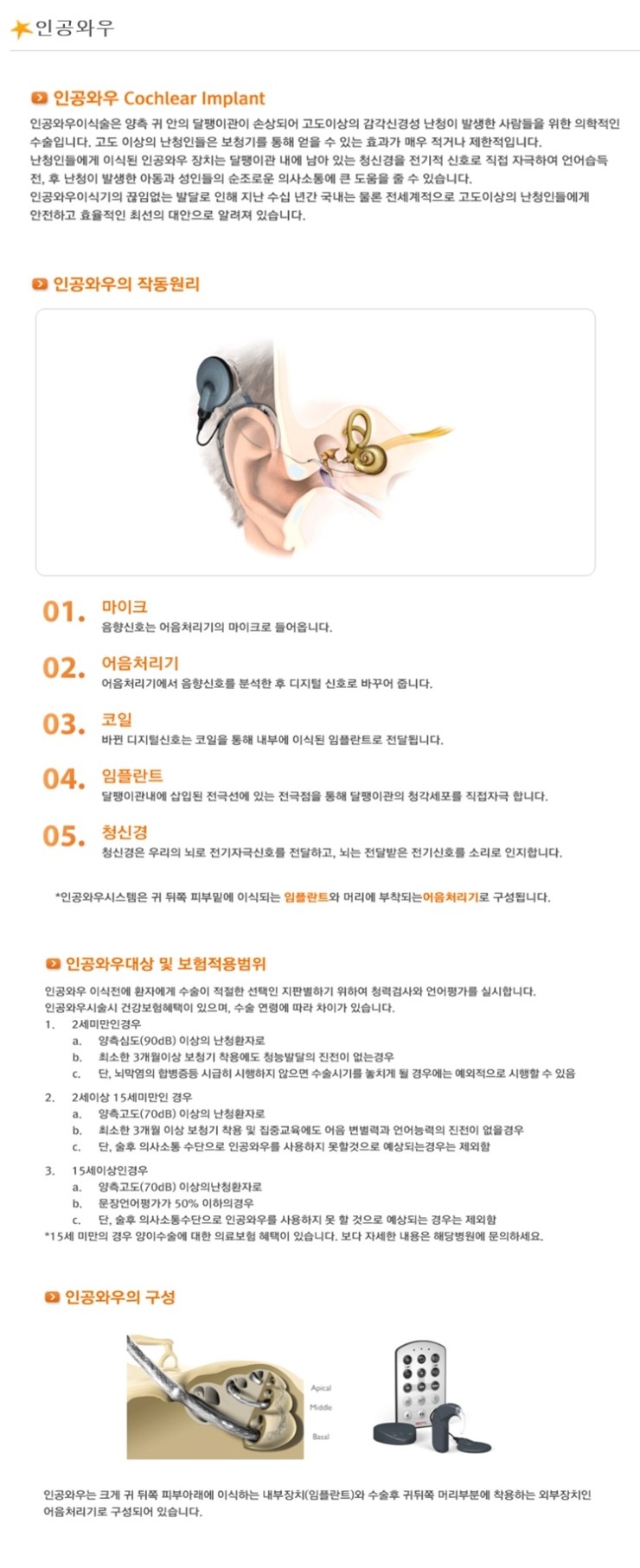  인공와우