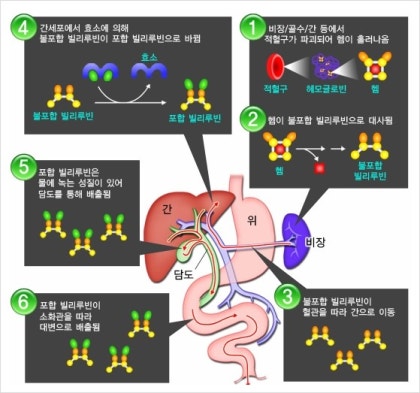 황달 박테리아