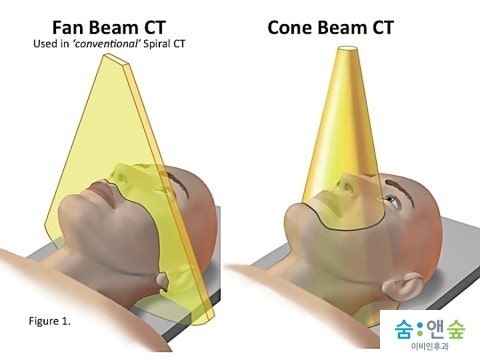 [숨앤숲 이비인후과] 저선량CT? 콘빔CT(Cone Beam CT)?