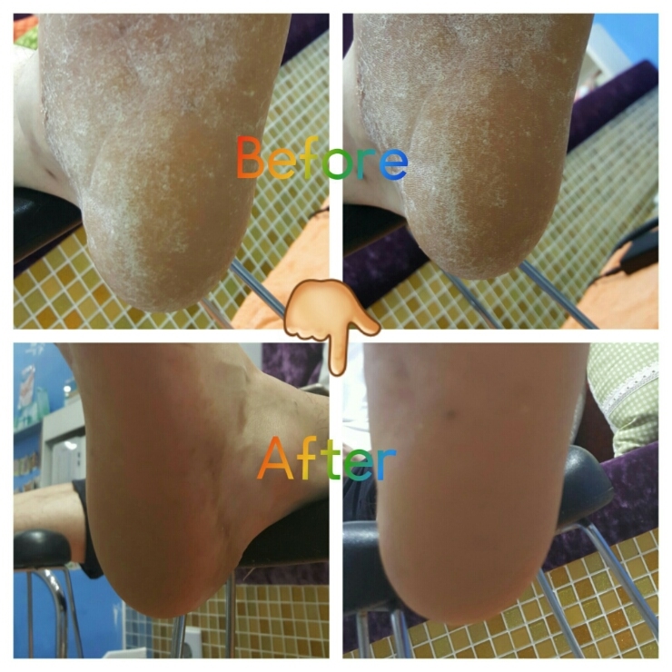 분당용인수지보정죽전네일샵/주네일/남자발각질관리 분당용인수지보정죽전네일샵/주네일/남자발각질관리