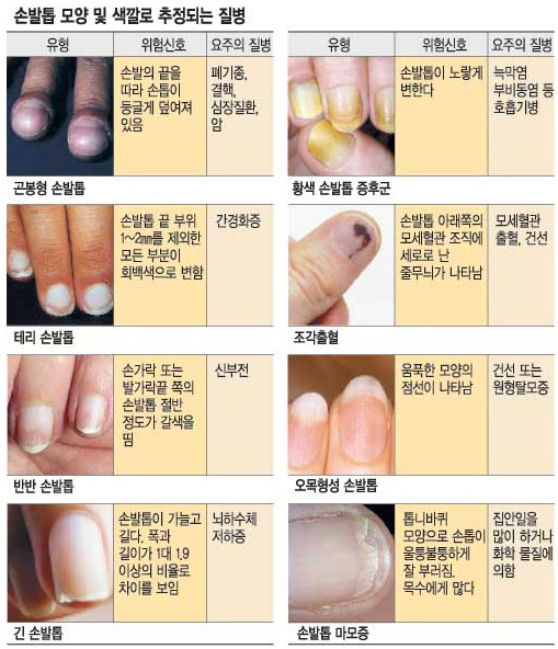 손톱 반달 건강 알아보기 5