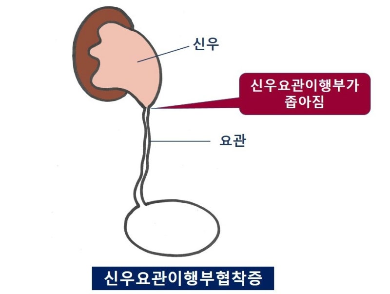수신증의 증상은 무엇입니까? 5