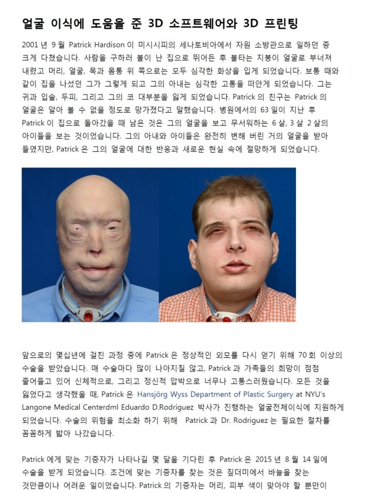  [3D 프린터 전문 주식회사 씨이피테크] 3D 소프트웨어(Virtual Surgical Planning)과 3D 프린팅을 이용한 얼굴 이식 수술 사례