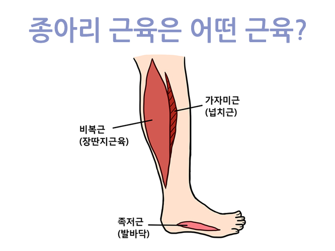 종아리근육풀기 통증의 원인을 찾아