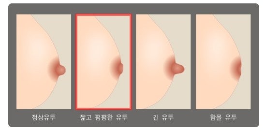 모유 수유 / 비늘 및 함몰 유두에 대한 정보 - 수유가 중요한 이유 1. / 모유 수유 지도 2