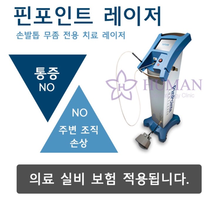손발톱무좀 임산부 · 간질환 환자도 가능한 치료법 - 핀포인트레이저 4