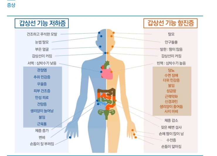갑상선 기능 항진증 자궁 용종으로 체중이 15kg까지 증가한 환자 치료 사례