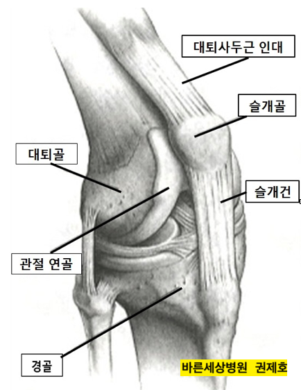 (무릎질환) 런너 무릎 (Runner's knee) / 제이본정형외과 권제호