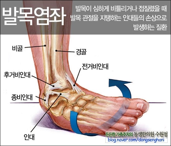 울산 북구 발목 염좌 세밀한 진단받는 치료, 침치료 한의원