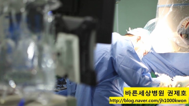 원위대퇴절골술 슬개골탈구 치료 방법 서울바른세상병원 권제호