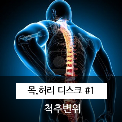  척추의 미세한 비틀어짐과 카이로프랙틱