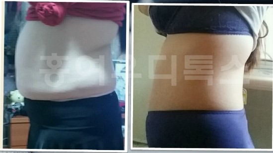  3일디톡스로 사이즈 대변신!! 누구나 가능!!!