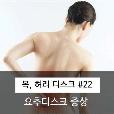  허리디스크 도수치료]허리 디스크 증상