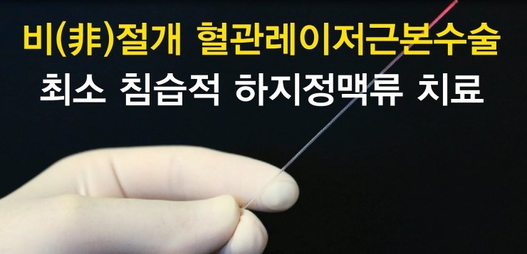 (부산흉부외과) 레이저 근치혈관재생술이란?