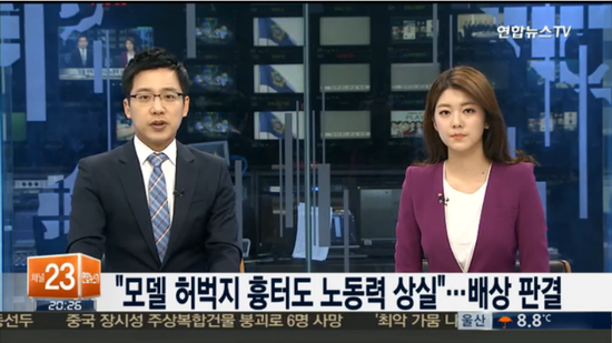 "모델 허벅지 흉터도 노동력 상실"..이례적 배상 판결 "모델 허벅지 흉터도 노동력 상실"..이례적 배상 판결