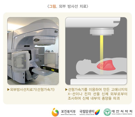 갑상선암 치료의 시너지 효과를 만들려면?