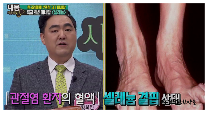 활성산소를 없애는 셀레늄의 진짜 효과는? 3