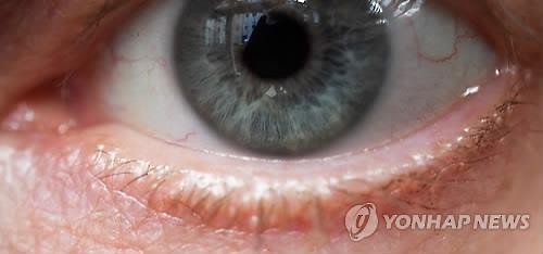 "다초점렌즈 삽입 백내장 수술, 보험금 지급대상" - 소비자분쟁조정위원회 결정 "다초점렌즈 삽입 백내장 수술, 보험금 지급대상" - 소비자분쟁조정위원회 결정