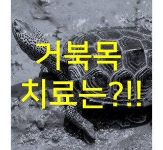  거북목. 일자목. 역c자목. 치료는 !!??