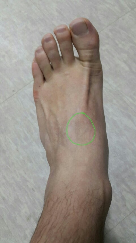 발등 저림이 계속 발생하고 있어요?