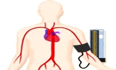  대사증후군이란 어떤 질환이며 예방 방법은 무엇일까 