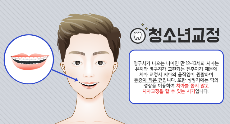 치아 교정 치료의 적기 시기를 정하는 방법은?