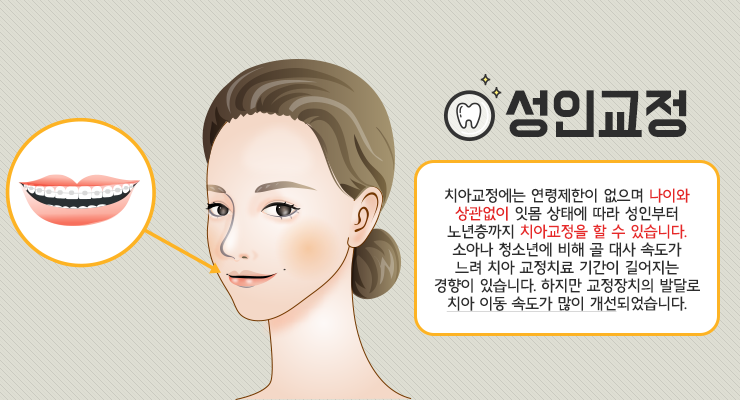 치아 교정 치료의 적기 시기를 정하는 방법은? 4