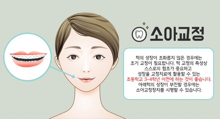 치아 교정 치료의 적기 시기를 정하는 방법은? 2