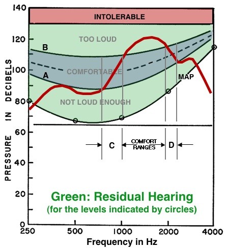 음압으로 귀의 능력을 측정하는 기본적인 개념