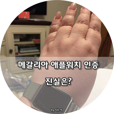 메갈리아 / 여시 애플 워치 족발 짤의 진실 : 네이버 블로그 메갈리아 / 여시 애플 워치 족발 짤의 진실 : 네이버 블로그