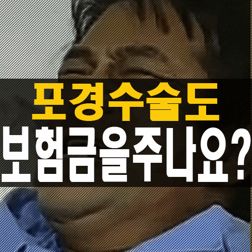 포경수술도 실비 보험금 받을수 있나요?