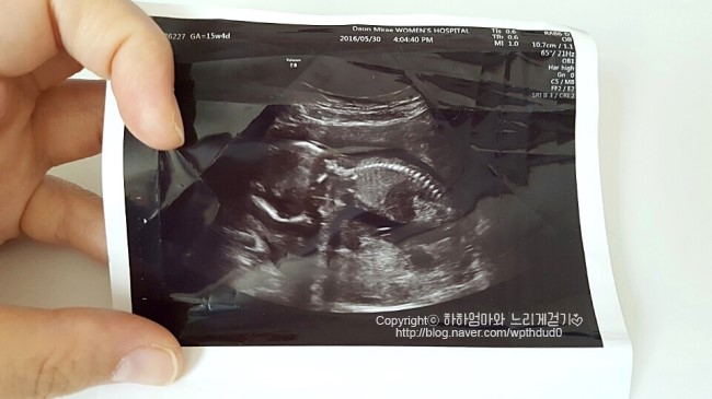  임신16주 성별확인?! + 하하남매일상