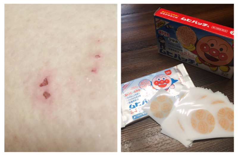 모기물린데 호빵맨 모기패치 정말 좋네요 : 네이버 블로그