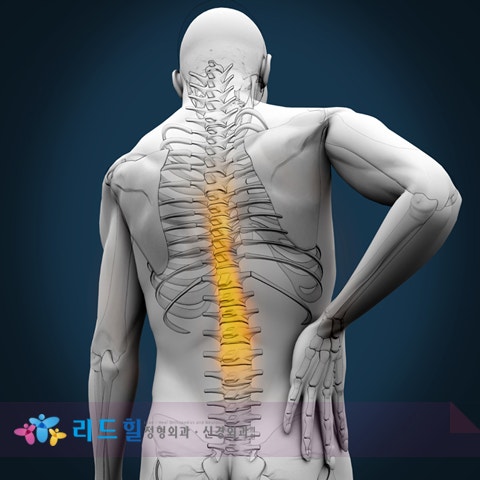 추간판 탈출증은 비수술 치료방법으로 해결 : 네이버 블로그
