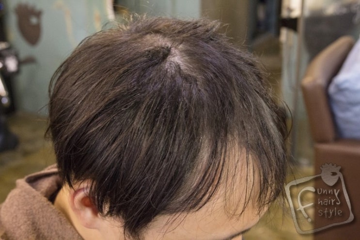 남자 앞머리 갈라짐은 퍼니M 스티커 붙임머리 증모술로 해결