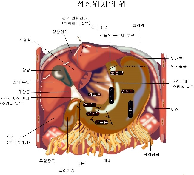  위암과 음식?
