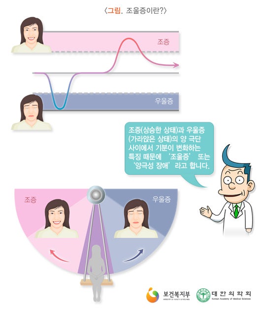 양극성 과도한 기분 변화, 조울증? 3